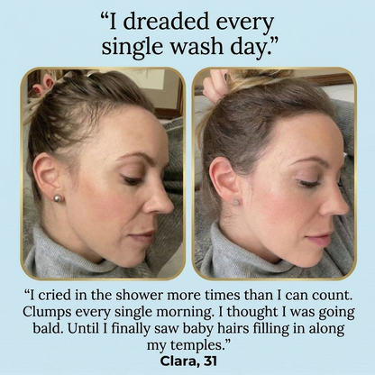 Lyvora Roll-On Serum